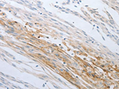 LOX Antibody