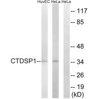 CTDSP1 Antibody