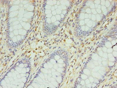 ENO3 Antibody
