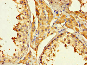 PAGE1 Antibody