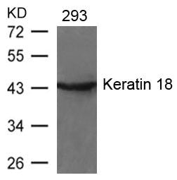 KRT18 (Ab-33) Antibody