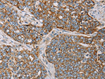 MTFP1 Antibody