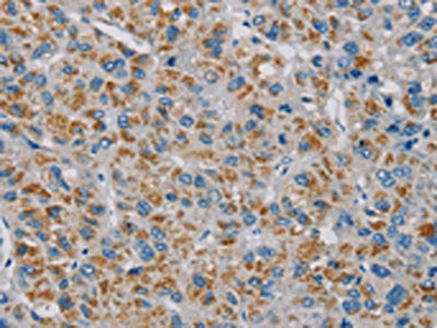 PNLIP Antibody