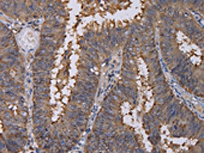REG3G Antibody