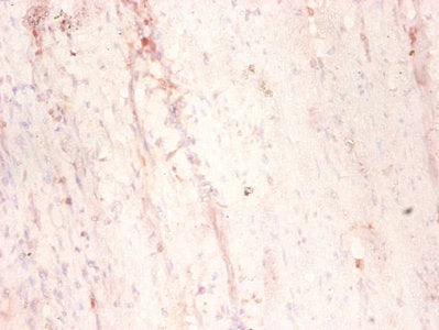 MAP1S Antibody