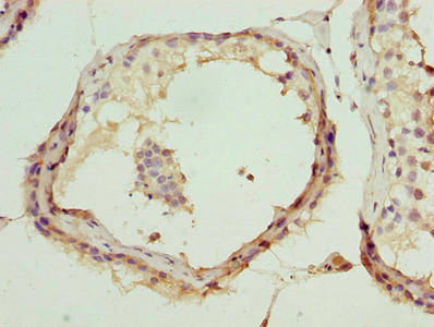 DDX55 Antibody