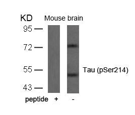 Phospho-MAPT (Ser214) Antibody