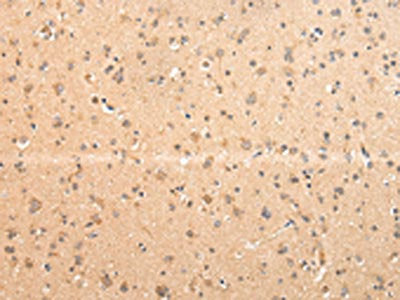 ATIC Antibody