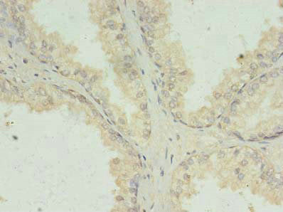 PRKRA Antibody