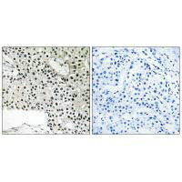 TCEAL4 Antibody