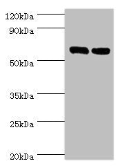 TROVE2 Antibody
