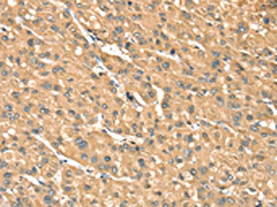 PHKB Antibody