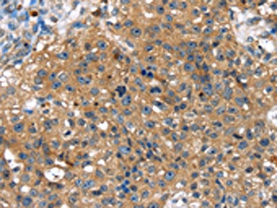 TBX10 Antibody