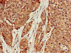 KRAS Antibody