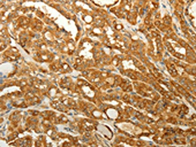 RAB35 Antibody