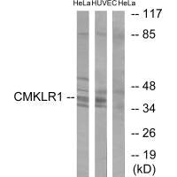 CMKLR1 Antibody