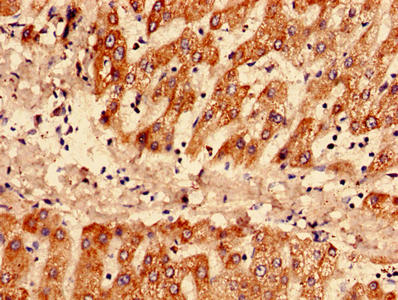 SAA1 Antibody