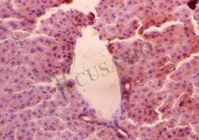 AGER Antibody