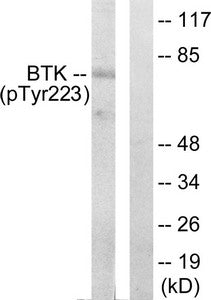 Phospho-BTK (Tyr223) Antibody