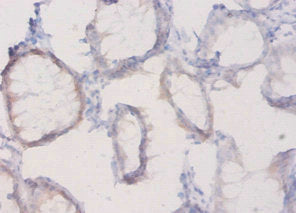 PLXNA1 Antibody