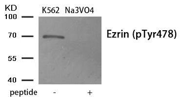 Phospho-EZR (Tyr478) Antibody