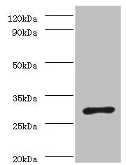 ureA Antibody