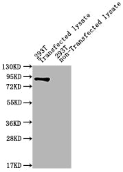 ureB Antibody