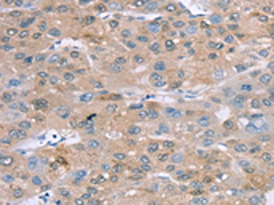 SULT2B1 Antibody