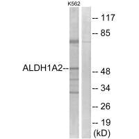 ALDH1A2 Antibody