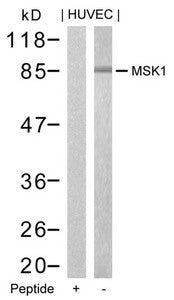 RPS6KA5 (Ab-376) Antibody