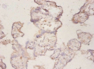 CP Antibody