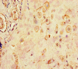 LHB Antibody