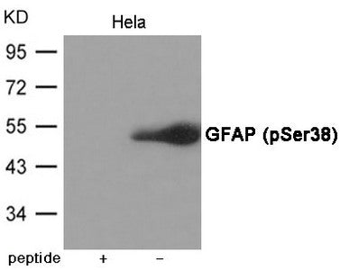 Phospho-GFAP (Ser38) Antibody