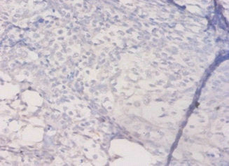 HLA-DQA1 Antibody