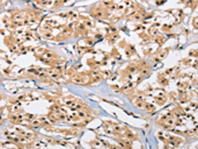 CARD8 Antibody