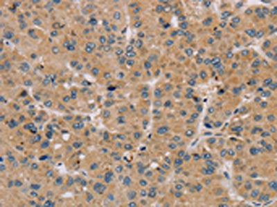 PARP3 Antibody