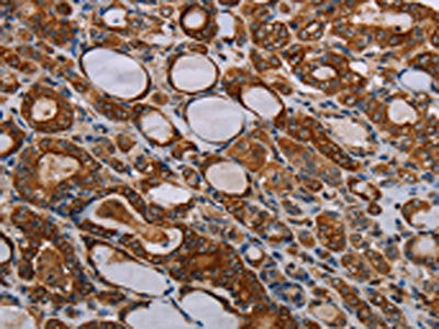 FABP3 Antibody