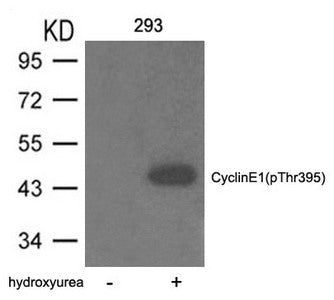 Phospho-CCNE1 (Thr395) Antibody