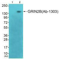 GRIN2B (Ab-1303) Antibody