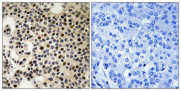 Phospho-PAK2 (Ser197) Antibody