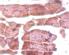 TTN Antibody