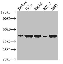 HLA-B Antibody