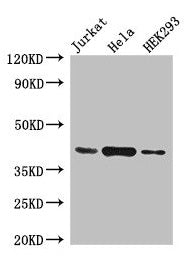 HLA-C Antibody