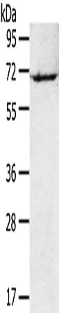 RAD17 Antibody