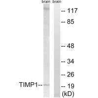 TIMP1 Antibody
