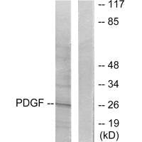 PDGFB Antibody