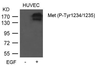 Phospho-MET (Tyr1234/1235) Antibody