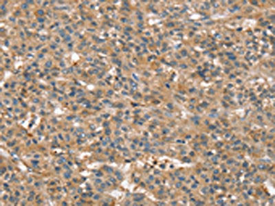 SSX2IP Antibody
