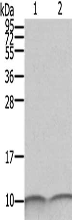 S100A6 Antibody