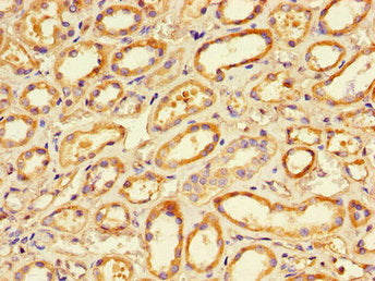 PRKCA Antibody